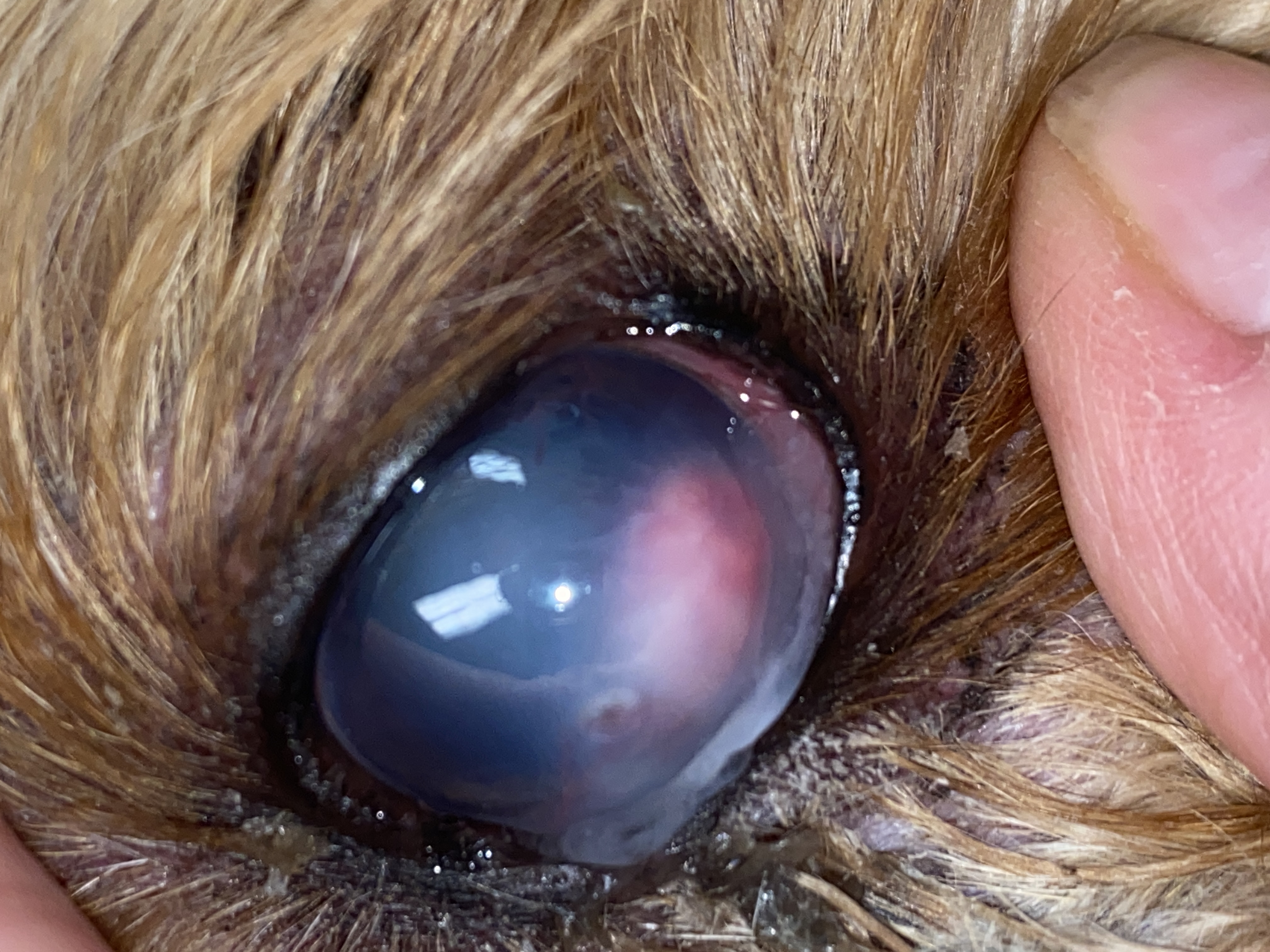 Hypopyon. Ulcer. Abscess